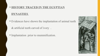 • HISTORY TRACED IN THE EGYPTIAN
DYNASTIES
• Evidences have shown the implantation of animal teeth
& artificial teeth carved of ivory .
• Implantation prior to mummification.
 
