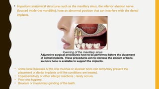 • Important anatomical structures such as the maxillary sinus, the inferior alveolar nerve
(located inside the mandible), have an abnormal position that can interfere with the dental
implants.
lowering of the maxillary sinus
Adjunctive surgical procedures have to be performed before the placement
of dental implants. These procedures aim to increase the amount of bone,
so more bone is available to support the implants.
• some local diseases of the oral mucosa or alveolar bone can temporary prevent the
placement of dental implants until the conditions are treated.
• Hypersensitivity or other allergic reactions ; rarely occurs.
• Poor oral hygiene.
• Bruxism or involuntary grinding of the teeth.
 