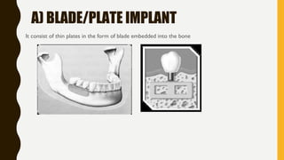 A) BLADE/PLATE IMPLANT
It consist of thin plates in the form of blade embedded into the bone
 