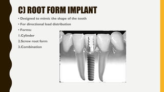 C) ROOT FORM IMPLANT
• Designed to mimic the shape of the tooth
• For directional load distribution
• Forms:
1.Cylinder
2.Screw root form
3.Combination
 