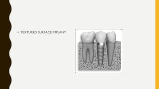 • TEXTURED SURFACE IMPLANT
 