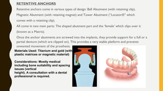 RETENTIVE ANCHORS
Retentive anchors come in various types of design: Ball Abutment (with retaining clip),
Magnetic Abutment (with retaining magnet) and Tower Abutment (“Locator®” which
comes with a retaining clip).
All come in two main parts: The shaped abutment part and the ‘female’ which clips over it
(known as a Matrix).
Once the anchor abutments are screwed into the implants, they provide support for a full or a
partial denture (which are clipped on). This provides a very stable platform and prevents
unwanted movement of the prosthesis.
Materials Used: Titanium and gold (with
plastic matrices or magnetic material)
Considerations: Mostly medical
including bone suitability and spacing
issues (vertical
height). A consultation with a dental
professional is required.
 