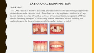 EXTRA ORAL EXAMINATION
SMILE LINE
The” LARS” factors as described by Ahmed, provides information for determining the appropriate
display of the maxillary anterior teeth. These factors are : lip length(short, medium, large), age
(elderly typically show less of maxillary and more of mandibular teeth), race(patients of African
descent frequently display less of the maxillary anterior teeth than Caucasian patients) , and
sex(females generally show twice as much of the maxillary incisors as males)
 