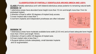 CLASSIFICATION OF PARTIALLY EDENTULOUS ARCHES (MISCH AND JUDY)
CLASS I Partially edentulous arch with bilateral edentulous areas posterior to remaining natural teeth.
DIVISION “A”
1.edentulous areas have abundant bone height more than 10 mm and length more than 7mm for
endosteal implant.
2.direction of load is within 30 degrees of implant body access.
3.crown implant ratio is less than 1.
4.root form implants and independent prostheses are often indicated
DIVISION “B”
1.Edentulous areas have moderate available bone width (2.5-5 mm) and at least adequate bone height
more than (10mm and length 15mm)
2.Direction of load is within 20 degrees of implant axis.
3.Crown implant ratio is less than 1
4.Surgical options include osteoplasty, small diameter implants
and /or augmentation.
 