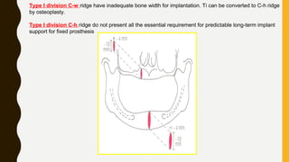 Type I division C-w ridge have inadequate bone width for implantation. Ti can be converted to C-h ridge
by osteoplasty.
Type I division C-h ridge do not present all the essential requirement for predictable long-term implant
support for fixed prosthesis
 