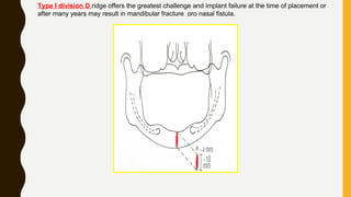 Type I division D ridge offers the greatest challenge and implant failure at the time of placement or
after many years may result in mandibular fracture oro nasal fistula.
 