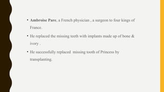 • Ambroise Pare, a French physician , a surgeon to four kings of
France.
• He replaced the missing teeth with implants made up of bone &
ivory .
• He successfully replaced missing tooth of Princess by
transplanting.
 