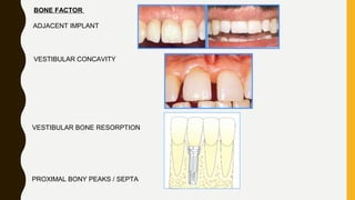 BONE FACTOR
ADJACENT IMPLANT
VESTIBULAR CONCAVITY
VESTIBULAR BONE RESORPTION
PROXIMAL BONY PEAKS / SEPTA
 
