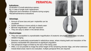 PERIAPICAL
Indications:
•Evaluation of small edentulous spaces ,
Eg: in case of single tooth replacement
•Alignment and orientation of implants during surgery
•Recall/maintenance evaluations
Advantage
• Amount of bone loss and peri- implantitis can be
visualized
• Subtle variations in bone activity is clearly seen
• Minimal magnification with high resolution
• They are easy to obtain in the dental clinics.
Disadvantages
• They are susceptible to unpredictable magnification of anatomic structures, which does not allow
reliable imaging.
• Distortion is particularly accentuated in edentulous areas, where missing teeth and resorption of the
alveolus necessitate film placement at significant angulation
• The periapical image is limited by the size of film being used
• Often, it is not possible to image the entire height of the remaining alveolar ridge, and when extensive
mesial-distal areas need to be evaluated, multiple periapical films are required
 