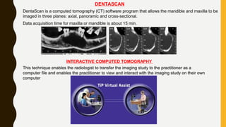 DENTASCAN
DentaScan is a computed tomography (CT) software program that allows the mandible and maxilla to be
imaged in three planes: axial, panoramic and cross-sectional.
Data acquisition time for maxilla or mandible is about 15 min.
INTERACTIVE COMPUTED TOMOGRAPHY
This technique enables the radiologist to transfer the imaging study to the practitioner as a
computer file and enables the practitioner to view and interact with the imaging study on their own
computer
 