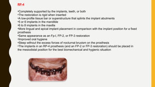 RP-4
•Completely supported by the implants, teeth, or both
•The restoration is rigid when inserted
•A low-profile tissue bar or superstructure that splints the implant abutments
•5 or 6 implants in the mandible
•6 to 8 implants in the maxilla
•More lingual and apical implant placement in comparison with the implant position for a fixed
prosthesis
•Same appearance as an Fp-l, FP-2, or FP-3 restoration
•Improved oral hygiene
•Sleep without the excess forces of nocturnal bruxism on the prosthesis
•The implants in an RP-4 prosthesis (and an FP-2 or FP-3 restoration) should be placed in
the mesiodistal position for the best biomechanical and hygienic situation
 