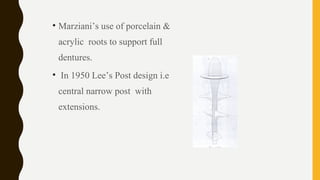 • Marziani’s use of porcelain &
acrylic roots to support full
dentures.
• In 1950 Lee’s Post design i.e
central narrow post with
extensions.
 