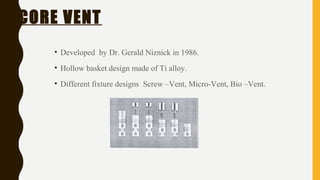 CORE VENT
• Developed by Dr. Gerald Niznick in 1986.
• Hollow basket design made of Ti alloy.
• Different fixture designs Screw –Vent, Micro-Vent, Bio –Vent.
 