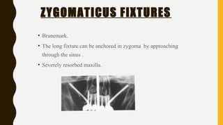 ZYGOMATICUS FIXTURES
• Branemark.
• The long fixture can be anchored in zygoma by approaching
through the sinus .
• Severely resorbed maxilla.
 