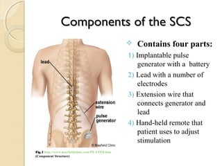 Spinal Cord Stimulation | PPT