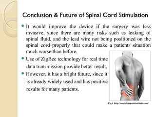 Oracle Pain Clinic - Spinal Cord Stimulation