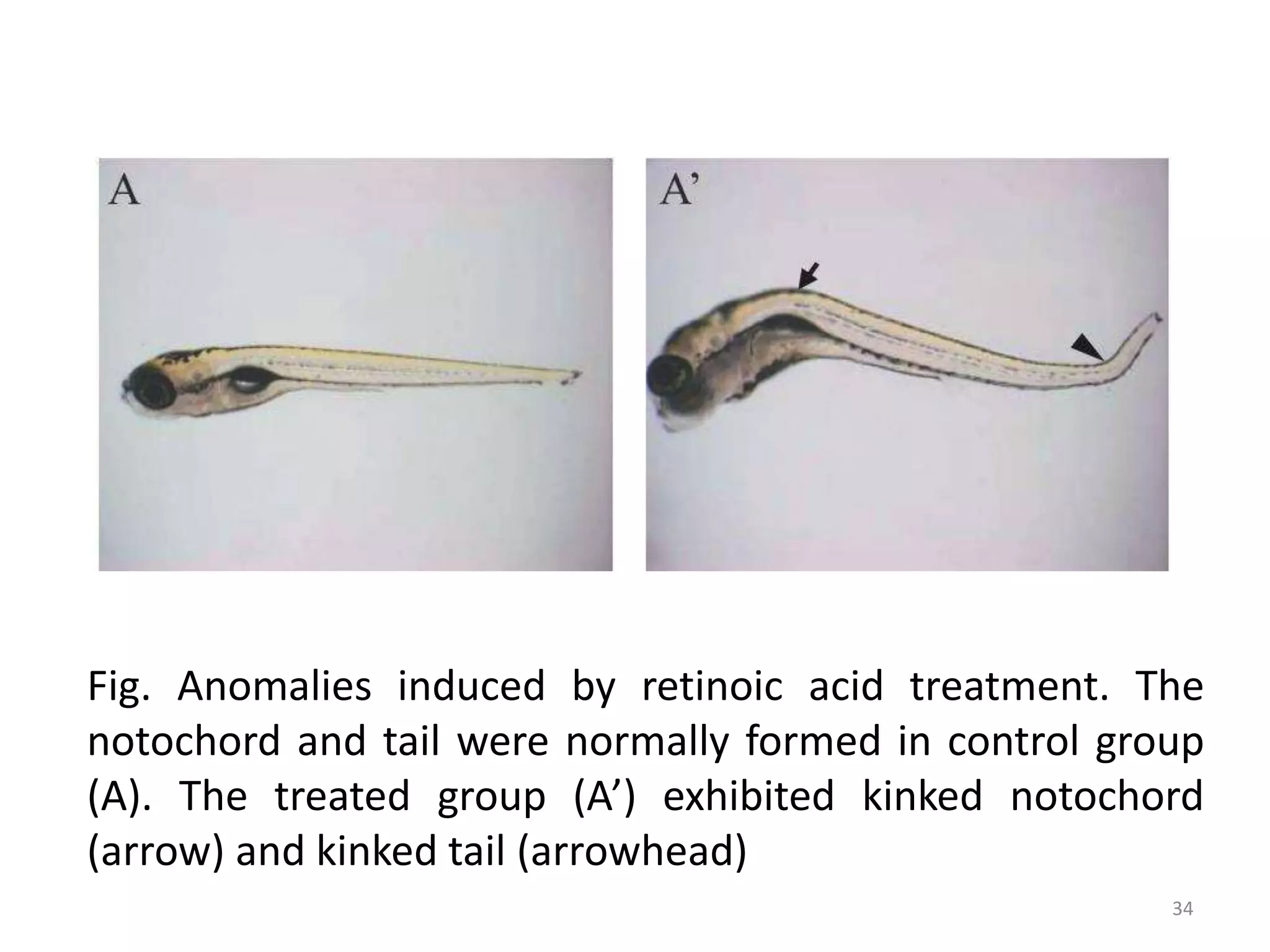Fig. Anomalies induced by retinoic acid treatment. The
notochord and tail were normally formed in control group
(A). The treated group (A’) exhibited kinked notochord
(arrow) and kinked tail (arrowhead)
34
 