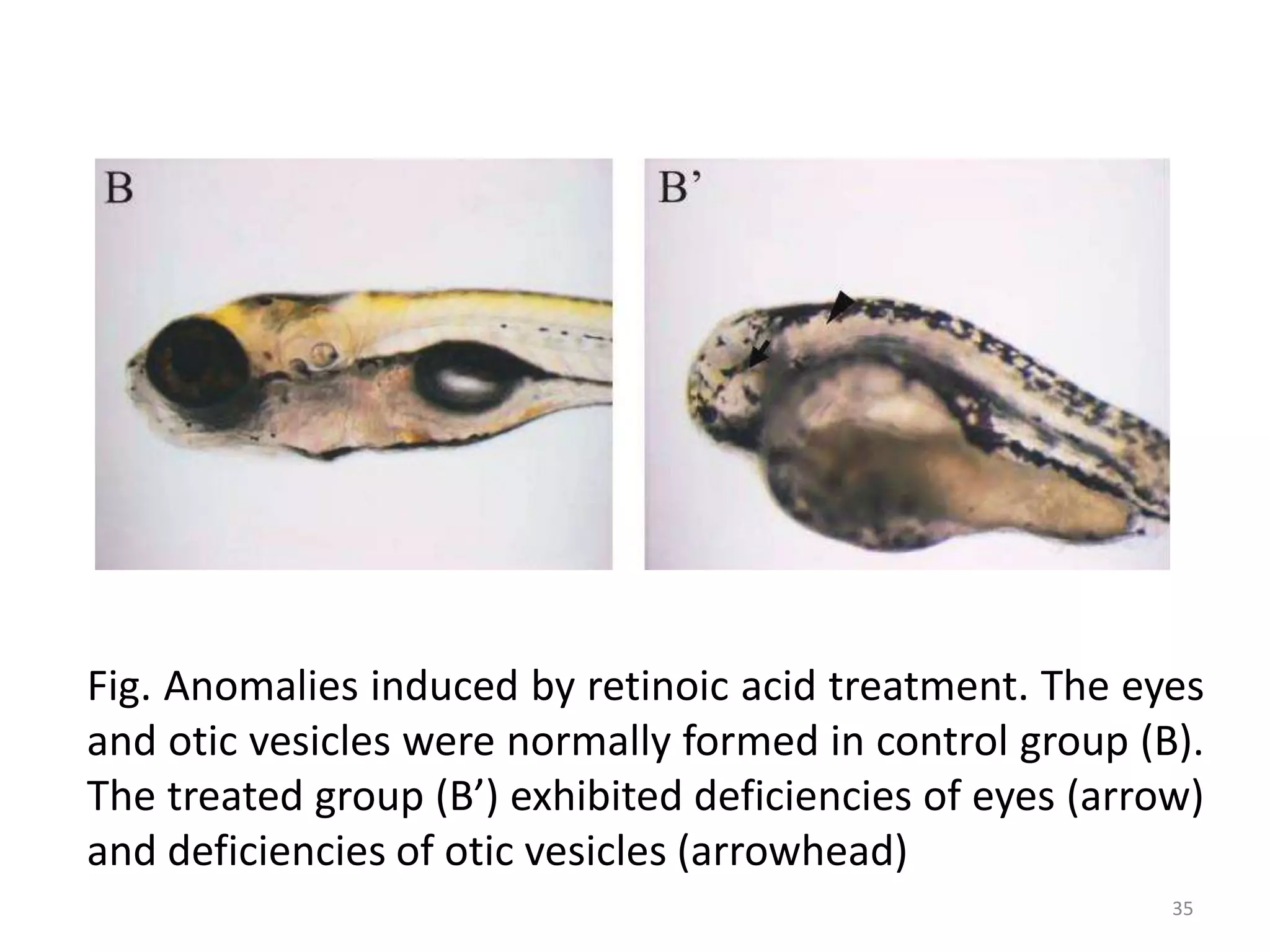 Fig. Anomalies induced by retinoic acid treatment. The eyes
and otic vesicles were normally formed in control group (B).
The treated group (B’) exhibited deficiencies of eyes (arrow)
and deficiencies of otic vesicles (arrowhead)
35
 