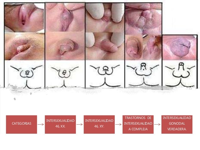 pic Que Es Una Hemafrodita genetica en los hermafroditas