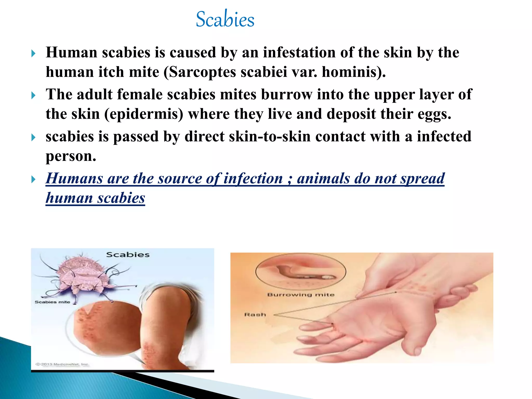  Human scabies is caused by an infestation of the skin by the
human itch mite (Sarcoptes scabiei var. hominis).
 The adult female scabies mites burrow into the upper layer of
the skin (epidermis) where they live and deposit their eggs.
 scabies is passed by direct skin-to-skin contact with a infected
person.
 Humans are the source of infection ; animals do not spread
human scabies
Scabies
 