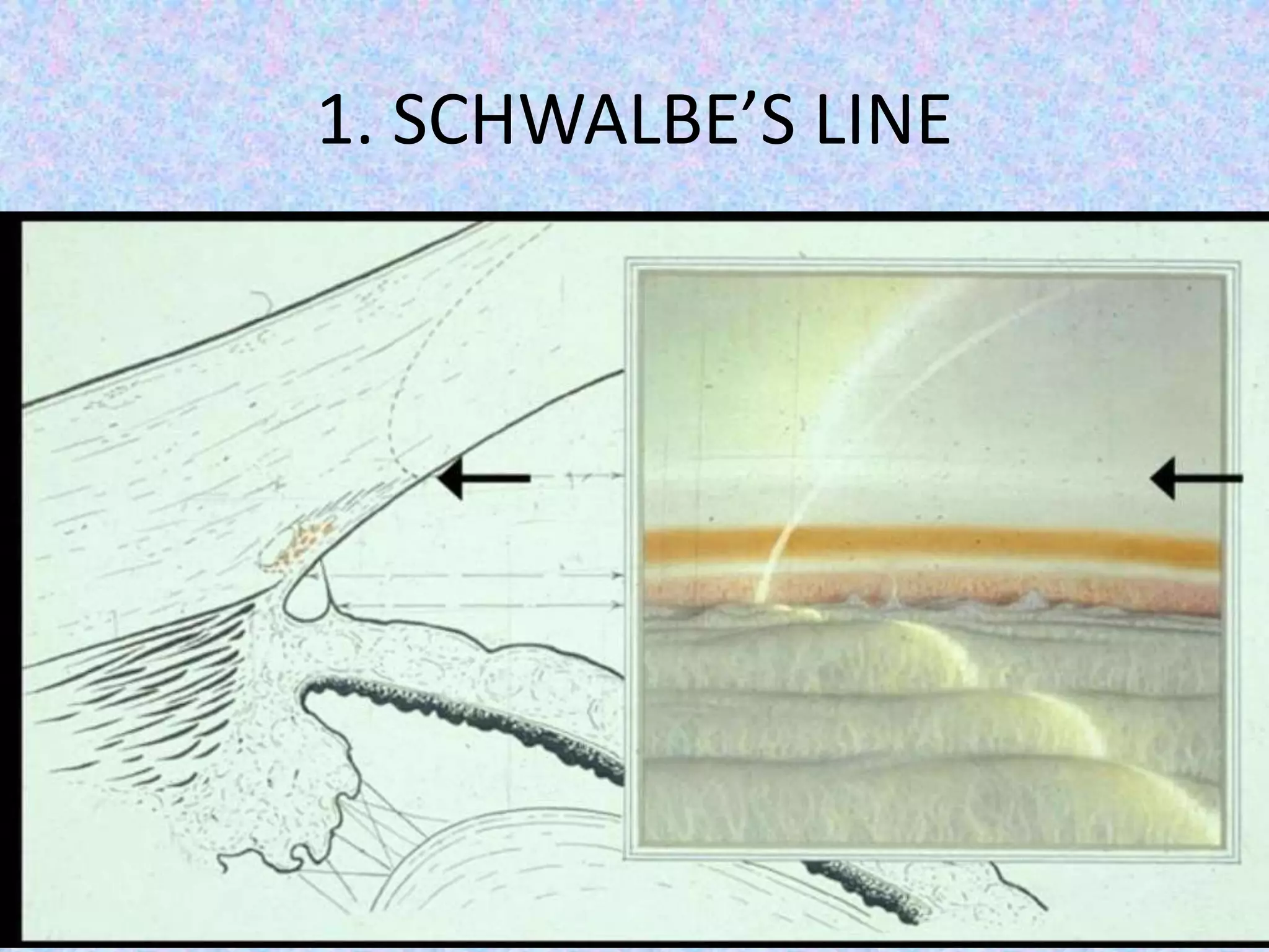 1. SCHWALBE’S LINE
 