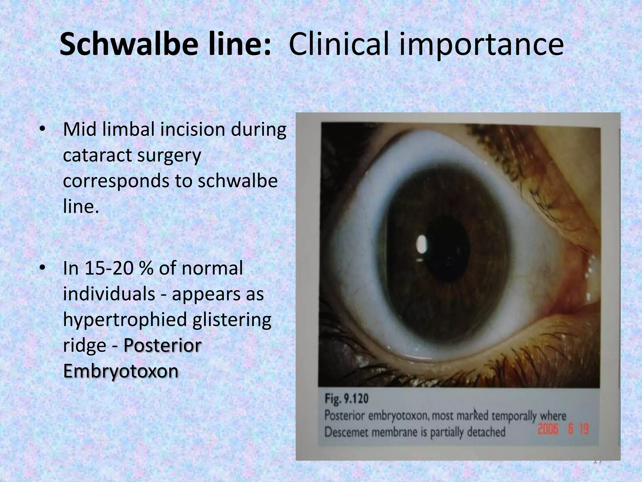 Schwalbe line: Clinical importance
• Mid limbal incision during
cataract surgery
corresponds to schwalbe
line.
• In 15-20 % of normal
individuals - appears as
hypertrophied glistering
ridge - Posterior
Embryotoxon
17
 