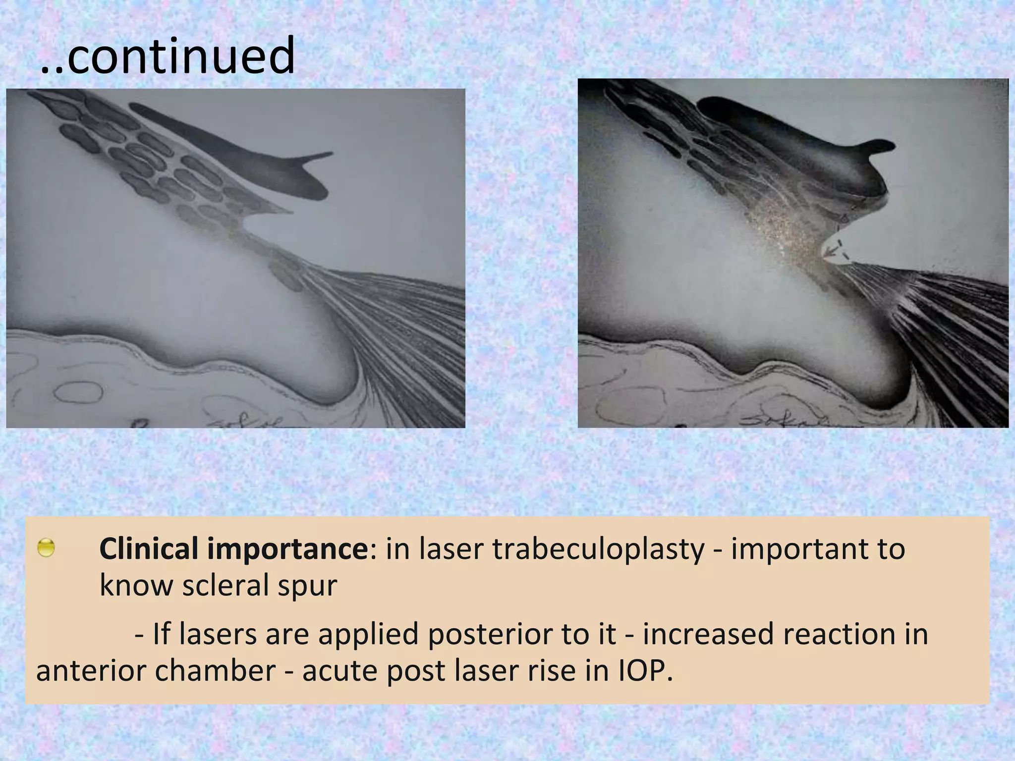 ..continued
Contain mechanoreceptors nerve ending to
measure stress at scleral spur caused by
change in IOP and ciliary muscle contraction.
Clinical importance: in laser trabeculoplasty - important to
know scleral spur
- If lasers are applied posterior to it - increased reaction in
anterior chamber - acute post laser rise in IOP.
 