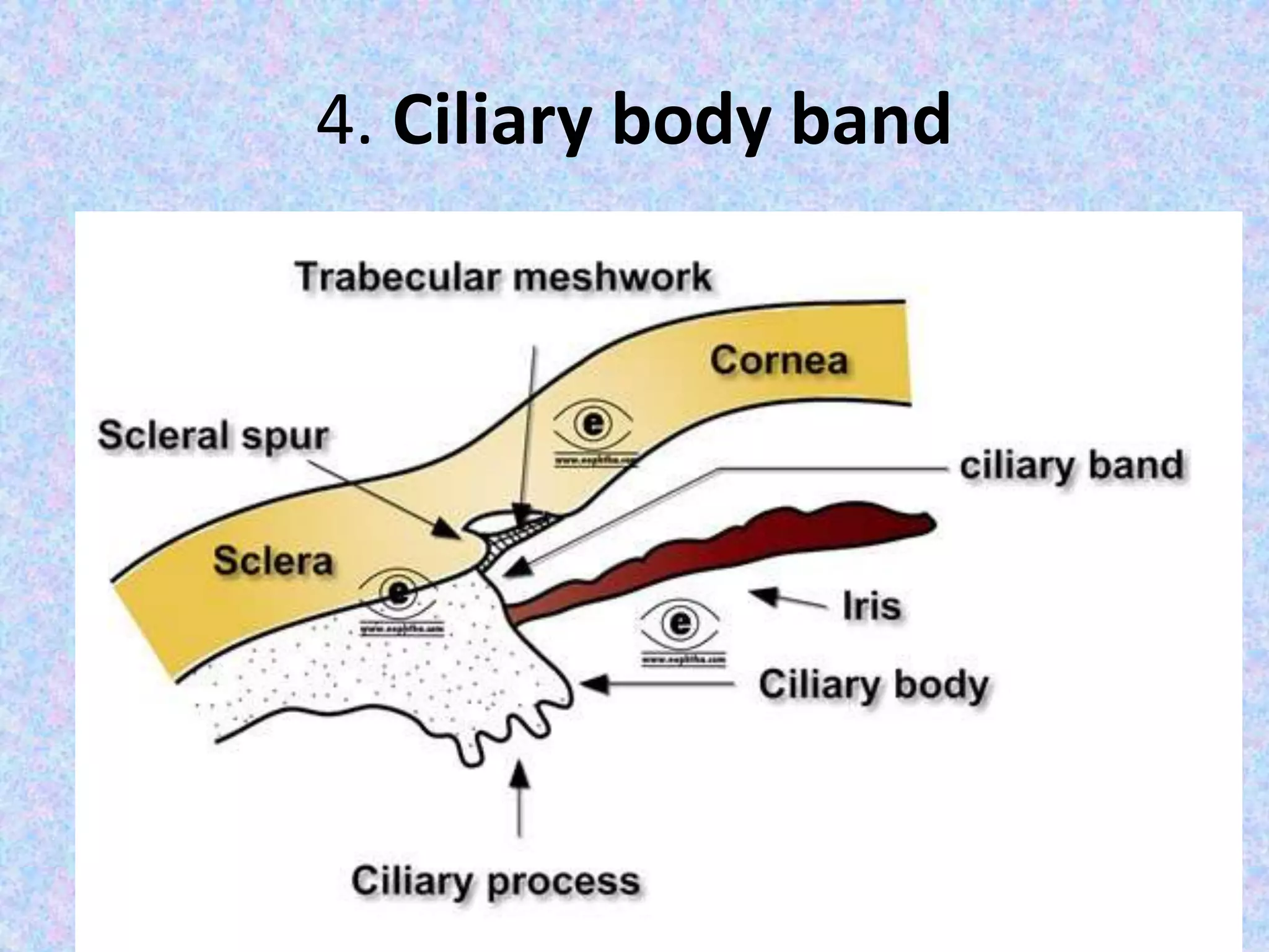 4. Ciliary body band
 