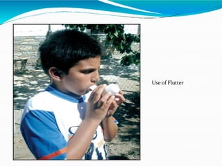 Use of Flutter
 