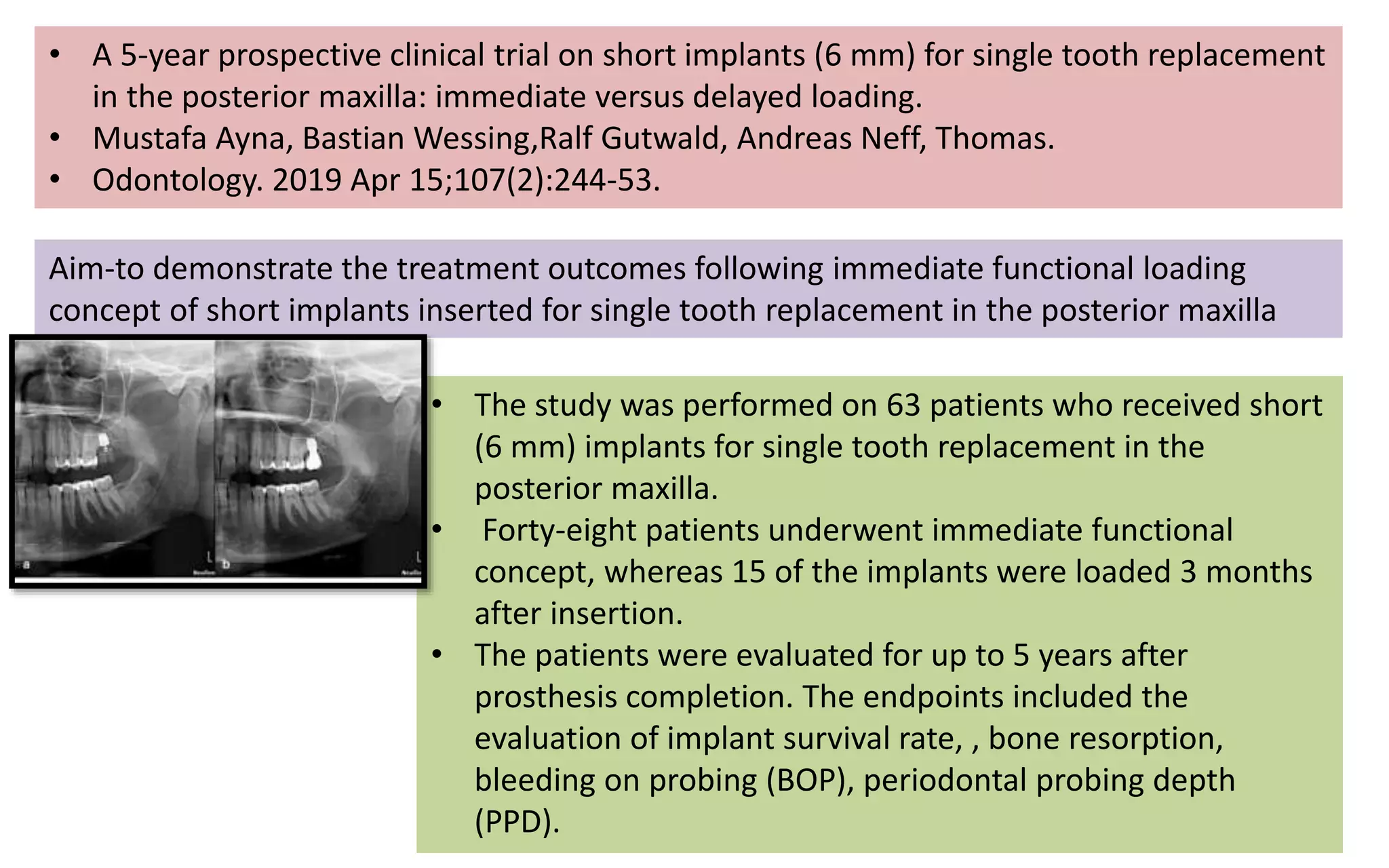 • A 5-year prospective clinical trial on short implants (6 mm) for single tooth replacement
in the posterior maxilla: immediate versus delayed loading.
• Mustafa Ayna, Bastian Wessing,Ralf Gutwald, Andreas Neff, Thomas.
• Odontology. 2019 Apr 15;107(2):244-53.
Aim-to demonstrate the treatment outcomes following immediate functional loading
concept of short implants inserted for single tooth replacement in the posterior maxilla
• The study was performed on 63 patients who received short
(6 mm) implants for single tooth replacement in the
posterior maxilla.
• Forty-eight patients underwent immediate functional
concept, whereas 15 of the implants were loaded 3 months
after insertion.
• The patients were evaluated for up to 5 years after
prosthesis completion. The endpoints included the
evaluation of implant survival rate, , bone resorption,
bleeding on probing (BOP), periodontal probing depth
(PPD).
 