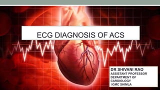 ECG DIAGNOSIS OF ACS
DR SHIVANI RAO
ASSISTANT PROFESSOR
DEPARTMENT OF
CARDIOLOGY
IGMC SHIMLA
 