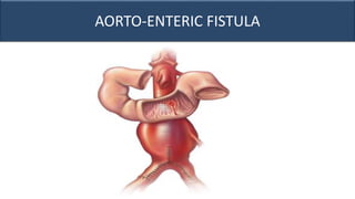 AORTO-ENTERIC FISTULA
 