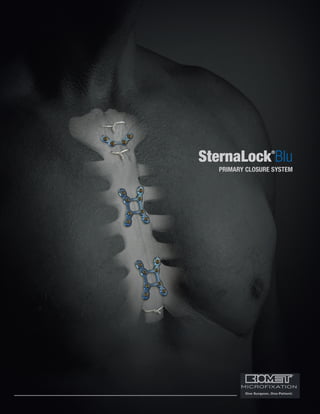SternaLock®
Blu
PRIMARY CLOSURE SYSTEM
 