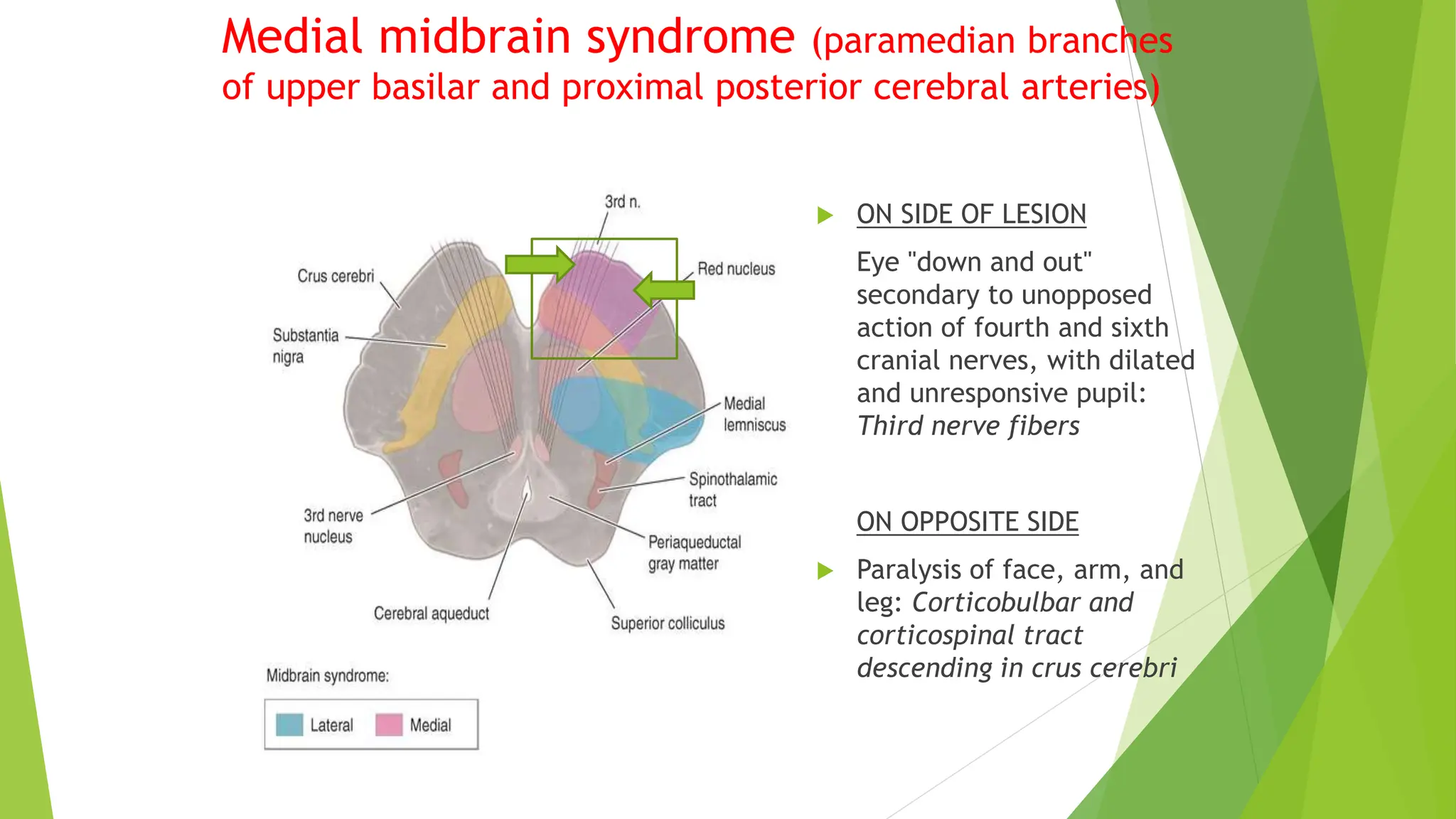 Final-Brainstem Syndromes and multiple Cranial nerve palsies.pptx