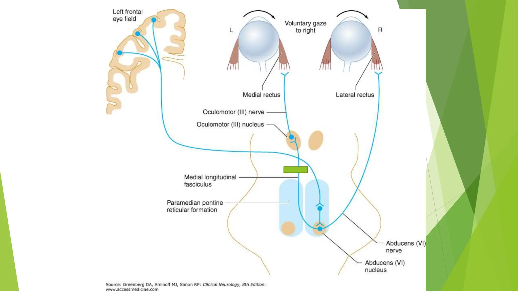 Final-Brainstem Syndromes and multiple Cranial nerve palsies.pptx