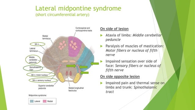 Final-Brainstem Syndromes and multiple Cranial nerve palsies.pptx