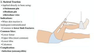 Comprehensive Guide to Traction and Splints in Orthopedic Care | PDF