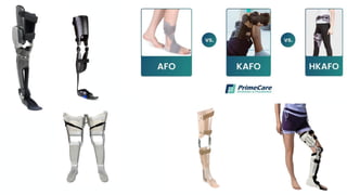 Comprehensive Guide to Traction and Splints in Orthopedic Care | PDF