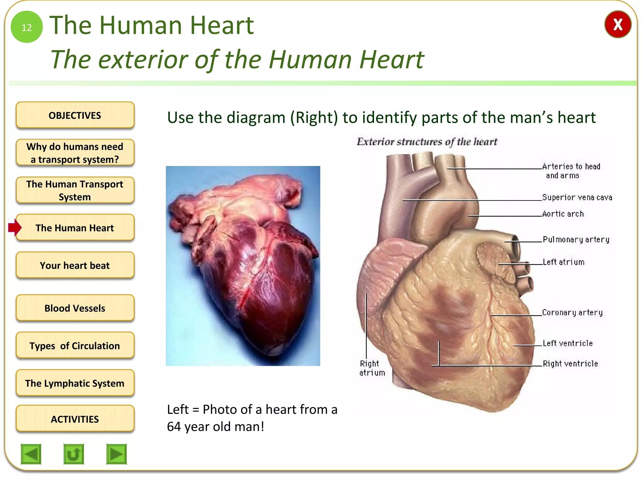 OBJECTIVES
The Human Transport
System
The Human Heart
Blood Vessels
Types of Circulation
ACTIVITIES
Your heart beat
The Lymphatic System
Why do humans need
a transport system?
The Human Heart
The exterior of the Human Heart
12
Left = Photo of a heart from a
64 year old man!
Use the diagram (Right) to identify parts of the man’s heart
 