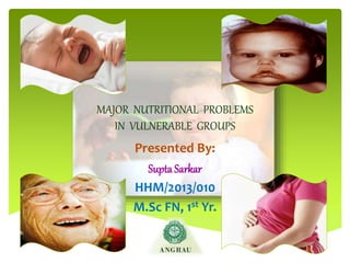 MAJOR NUTRITIONAL PROBLEMS
IN VULNERABLE GROUPS
Presented By:
Supta Sarkar
HHM/2013/010
M.Sc FN, 1st Yr.
 