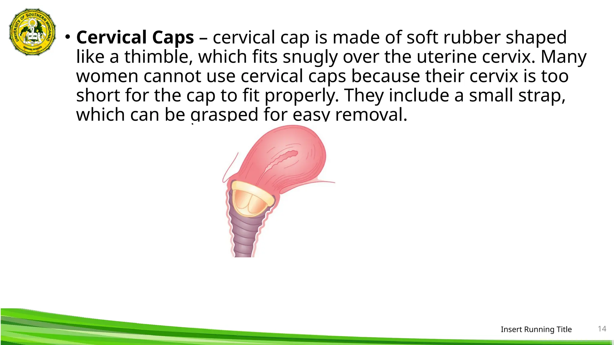 • Cervical Caps – cervical cap is made of soft rubber shaped
like a thimble, which fits snugly over the uterine cervix. Many
women cannot use cervical caps because their cervix is too
short for the cap to fit properly. They include a small strap,
which can be grasped for easy removal.
Insert Running Title 14
 