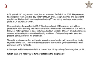 A 36 year old IV drug abuser, male, is a known case of AIDS since 2012. He presented
to emergency room with two-day history of fever, chills, cough, diarrhea and significant
weight loss. He has had poor complained with ART, not taking treatment since past 4
years. CD4 count is 354/mm³.
On examination, he was febrile (38.2°C) with a pulse of 114 beats/min and a blood
pressure of 124/73 mmHg. He had innumerable, widespread, macronodular skin lesions
that were heterogeneous in size, texture and colour. Multiple, diffuse 1 cm subcutaneous
masses, with and without associated dusky erythema of the overlying skin, were also
present, particularly over the chest wall.
The right wrist was swollen and tender along the ulnar border, with an overlying dusky
erythema of the skin. There was striking bilateral epitrochlear lymphadenopathy, most
prominent on the right side.
A biopsy of a skin lesion revealed the presence of faintly staining Gram-negative bacilli.
Which stain will help you to further establish the diagnosis?
3
 