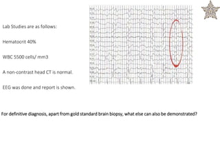 Lab Studies are as follows:
Hematocrit 40%
WBC 5500 cells/ mm3
A non-contrast head CT is normal.
EEG was done and report is shown.
For definitive diagnosis, apart from gold standard brain biopsy, what else can also be demonstrated?
 