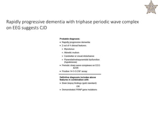 Rapidly progressive dementia with triphase periodic wave complex
on EEG suggests CJD
 