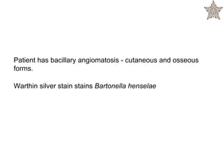 Patient has bacillary angiomatosis - cutaneous and osseous
forms.
Warthin silver stain stains Bartonella henselae
 