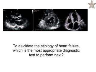 To elucidate the etiology of heart failure,
which is the most appropriate diagnostic
test to perform next?
 