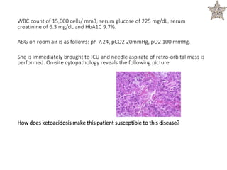 WBC count of 15,000 cells/ mm3, serum glucose of 225 mg/dL, serum
creatinine of 6.3 mg/dL and HbA1C 9.7%.
ABG on room air is as follows: ph 7.24, pCO2 20mmHg, pO2 100 mmHg.
She is immediately brought to ICU and needle aspirate of retro-orbital mass is
performed. On-site cytopathology reveals the following picture.
How does ketoacidosis make this patient susceptible to this disease?
 