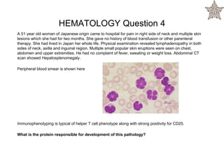 A 51 year old woman of Japanese origin came to hospital for pain in right side of neck and multiple skin
lesions which she had for two months. She gave no history of blood transfusion or other parenteral
therapy. She had lived in Japan her whole life. Physical examination revealed lymphadenopathy in both
sides of neck, axilla and inguinal region. Multiple small popular skin eruptions were seen on chest,
abdomen and upper extremities. He had no complaint of fever, sweating or weight loss. Abdominal CT
scan showed Hepatosplenomegaly.
Peripheral blood smear is shown here
Immunophenotyping is typical of helper T cell phenotype along with strong positivity for CD25.
What is the protein responsible for development of this pathology?
HEMATOLOGY Question 4
 