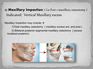 2) Maxillary Impaction: ( Le Fort 1 maxillary osteotomy )
Indicated: Vertical Maxillary excess
Maxillary Impaction may include 
1)Total maxillary osteotomy ( maxillary excess ant. and post.)
2) Bilateral posterior segmental maxillary osteotomy ( excess
localized posterior)
 