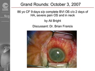 Grand Rounds: October 3, 2007 86 yo CF 9 days s/p complete BVI OS c/o 2 days of HA, severe pain OS and in neck by Ali Bright Discussant: Dr. Brian Francis 